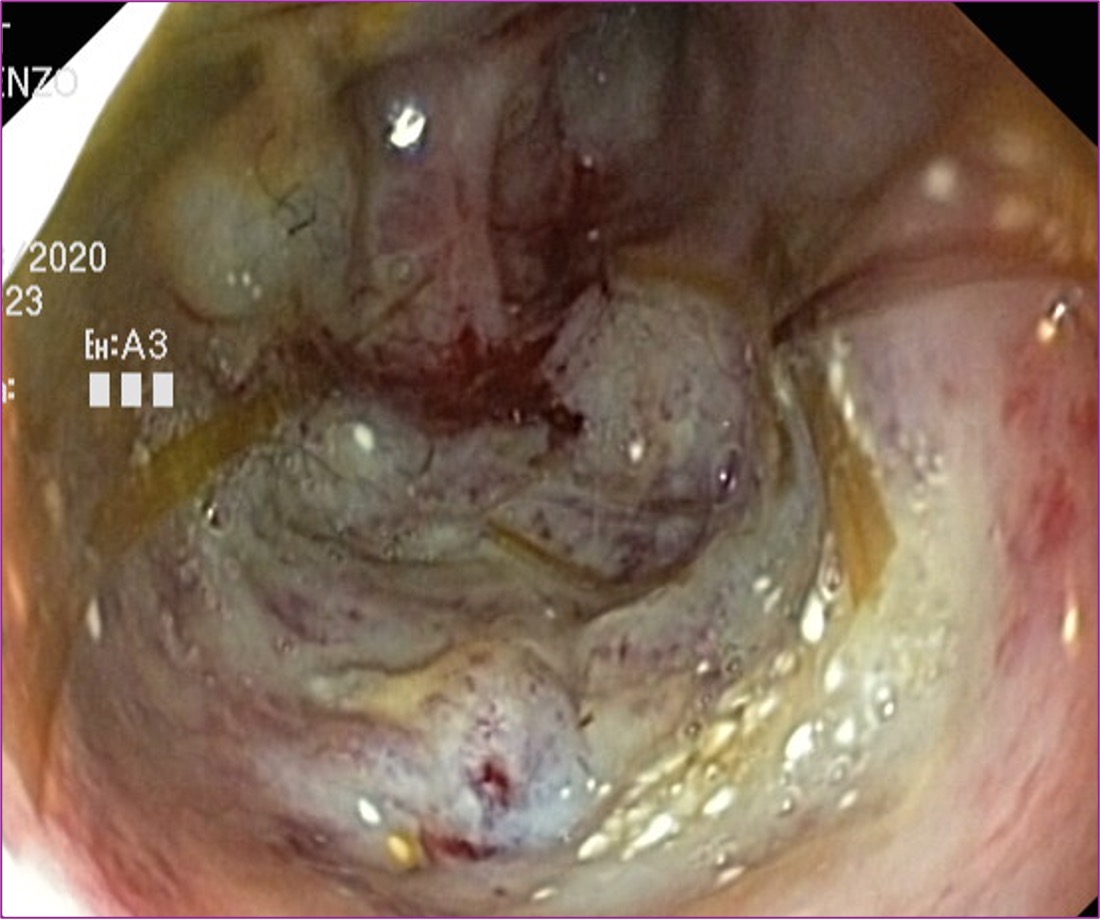 Formation ENDO-NA2J : Techniques d'endoscopie digestive et respiratoire