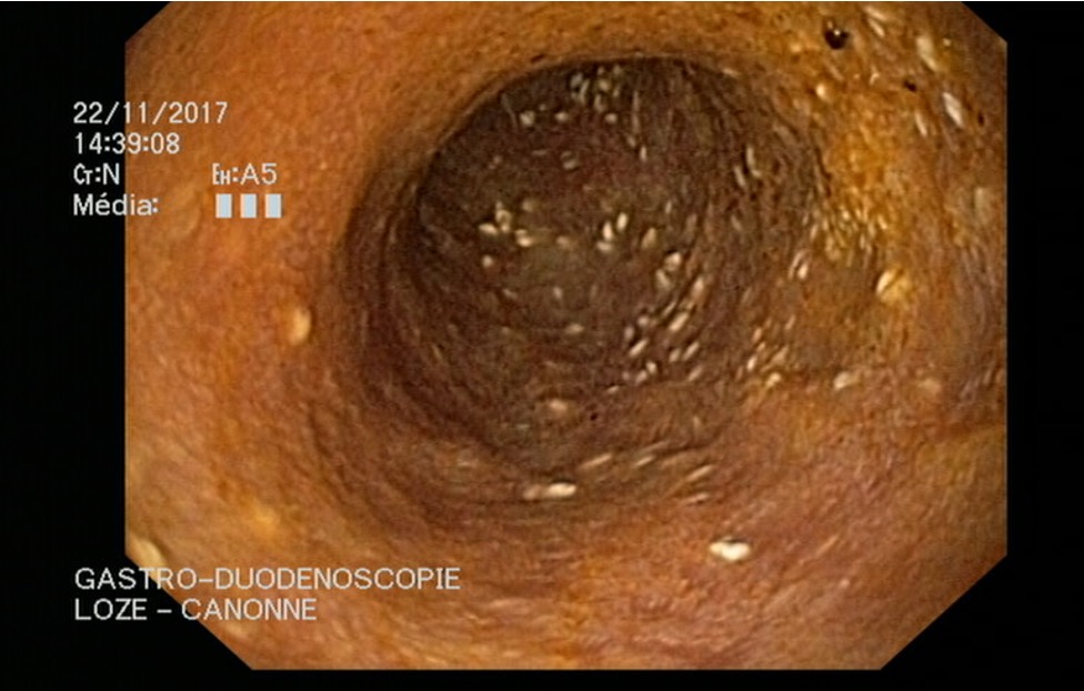 Formation ENDO-NA2J : Techniques d'endoscopie digestive et respiratoire