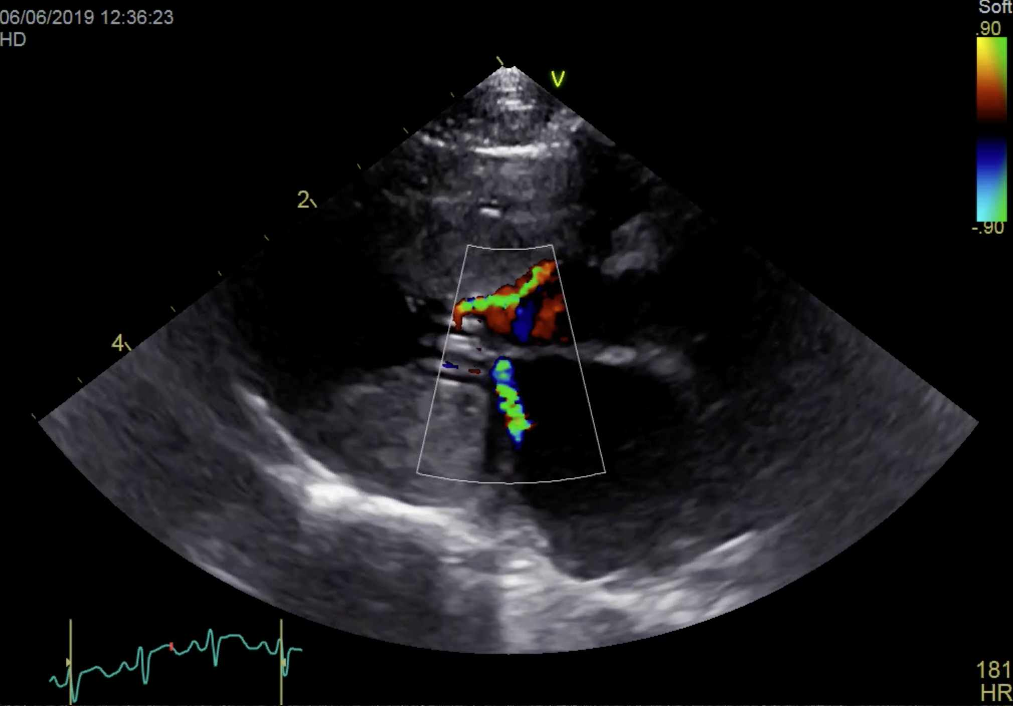 Formation CY-CARCT : Cycle en cardiologie féline