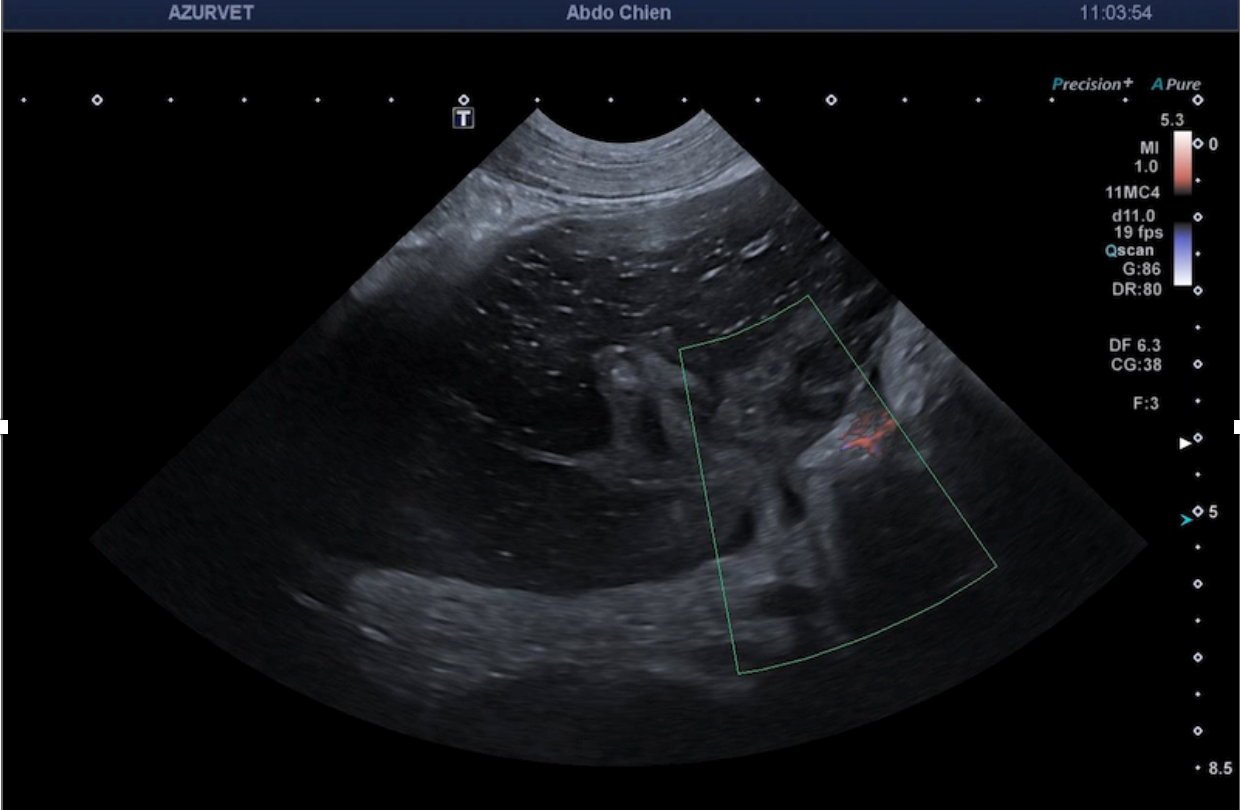 Formation EAP3-LIVE : Echographie abdominale pathologique: Tube digestif, pancréas et surrénales