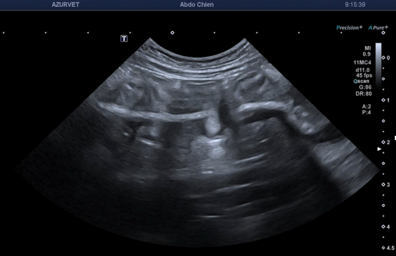 Formation EAP3-LIVE : Echographie abdominale pathologique: Tube digestif, pancréas et surrénales