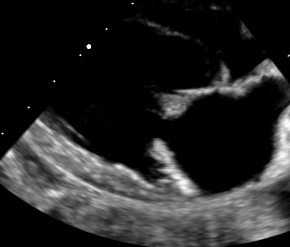 Formation EC009 : Perfectionner ma pratique en échocardiographie au quotidien à travers des cas cliniques. Partie 1.