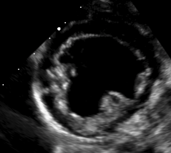 Formation EC009 : Perfectionner ma pratique en échocardiographie au quotidien à travers des cas cliniques. Partie 1.