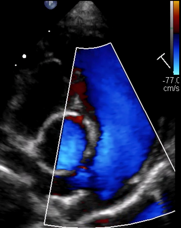 Formation EC0010 : Perfectionner ma pratique en échocardiographie au quotidien à travers des cas cliniques. Partie 2.