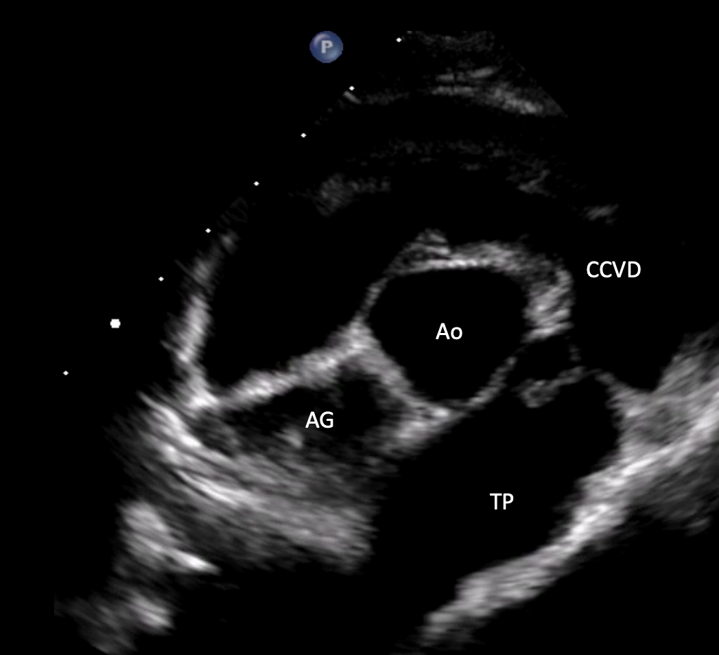 Formation EC009 : Perfectionner ma pratique en échocardiographie au quotidien à travers des cas cliniques. Partie 1.