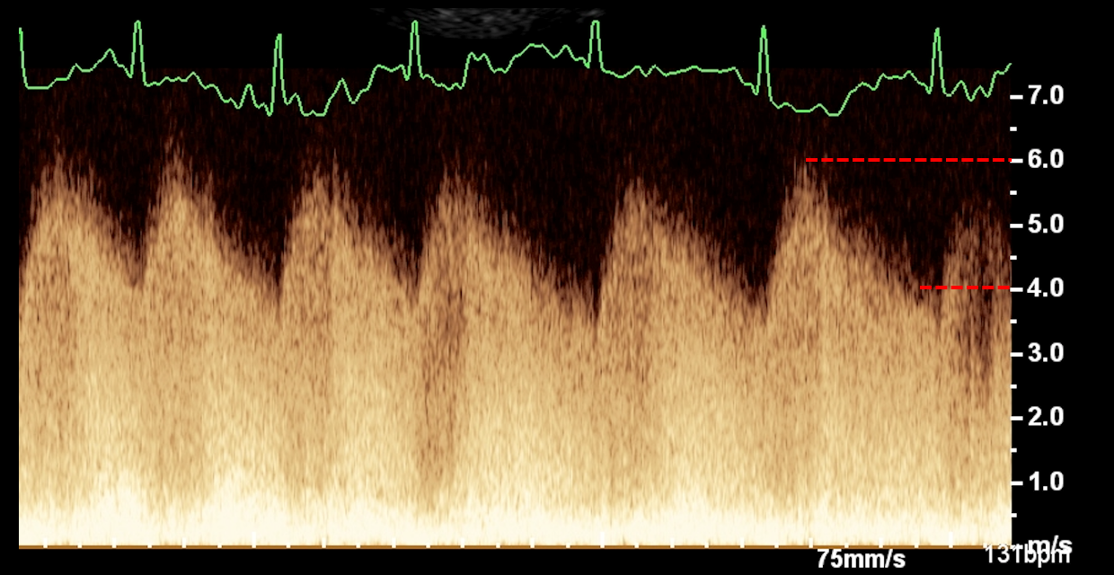 Formation EC009 : Perfectionner ma pratique en échocardiographie au quotidien à travers des cas cliniques. Partie 1.