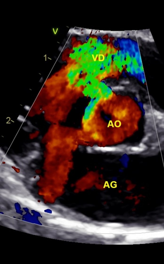 Formation CY-CAR : Cycle en cardiologie canine et féline : médecine et échocardiographie