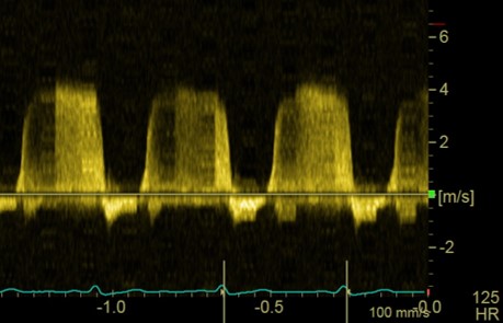 Formation CY-CAR : Cycle en cardiologie canine et féline : médecine et échocardiographie