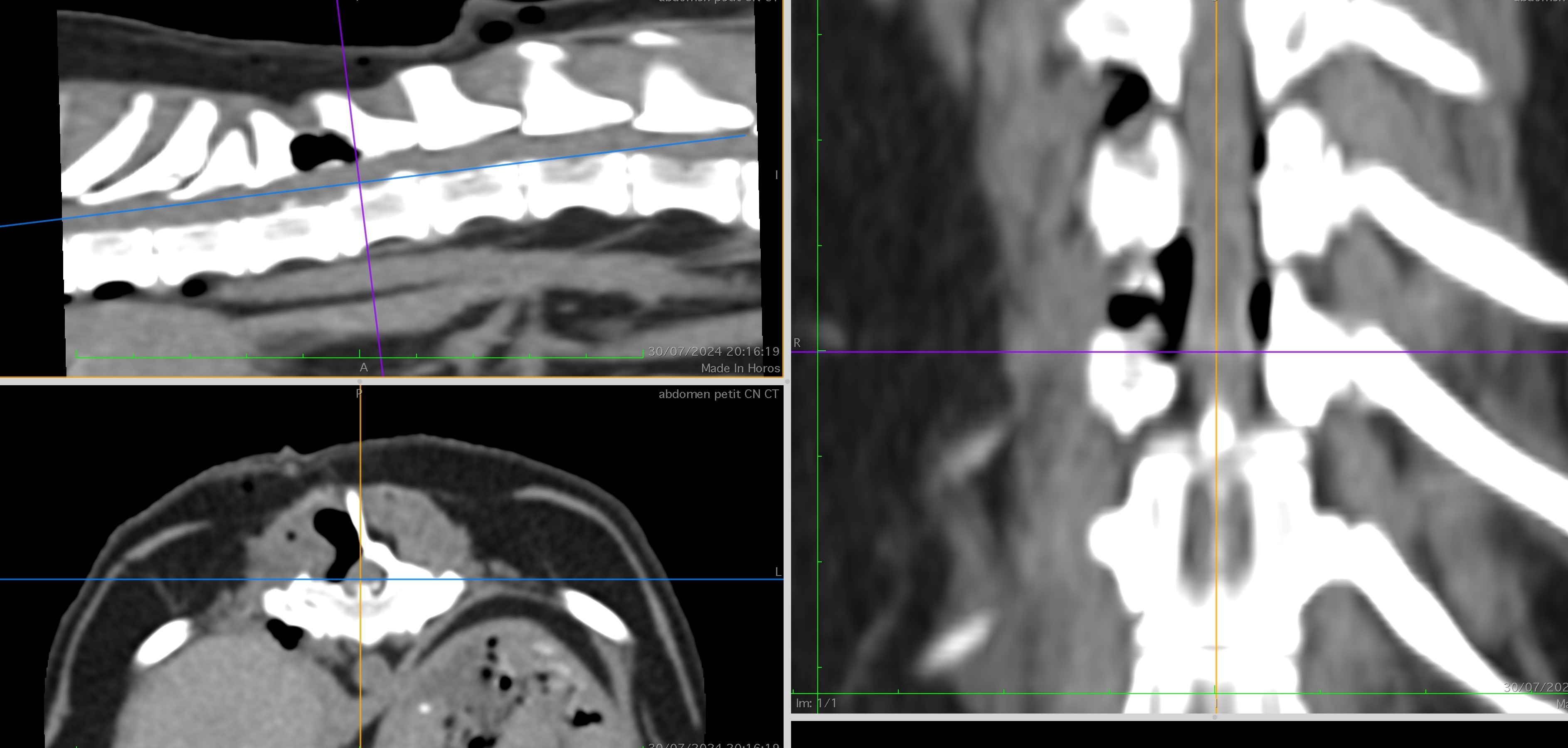 Formation NCHIR1 : Neurochirurgie de base : hémilaminectomie thoracolombaire et alternatives