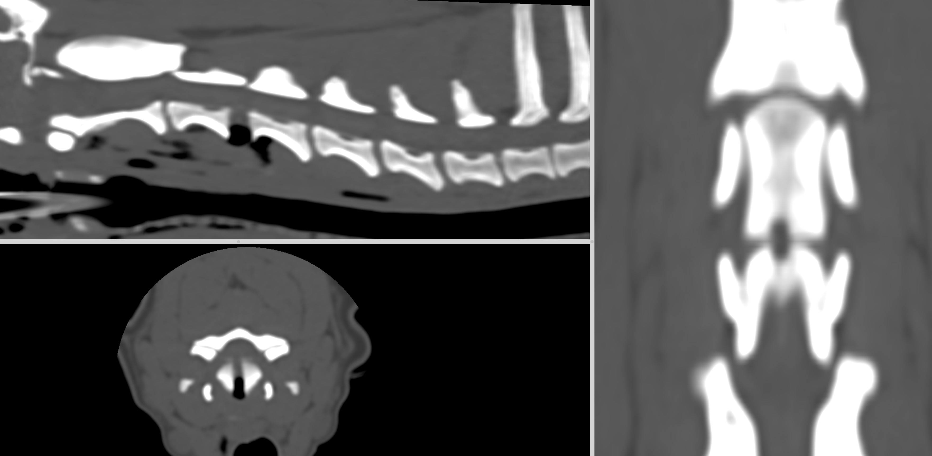 Formation NCHIR2-B : Neurochirurgie avancée : corpectomie cervicale et introduction à la stabilisation