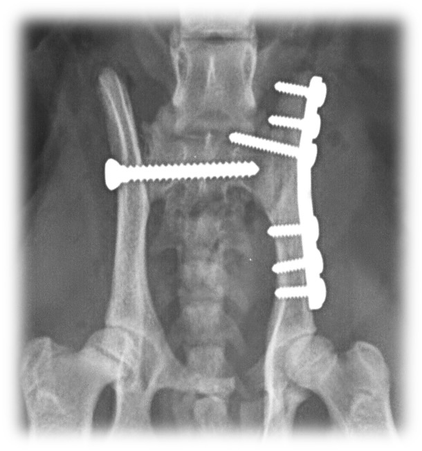 Formation CHIR6B : Chirurgie du bassin : quand et comment traiter les fractures pelviennes ?