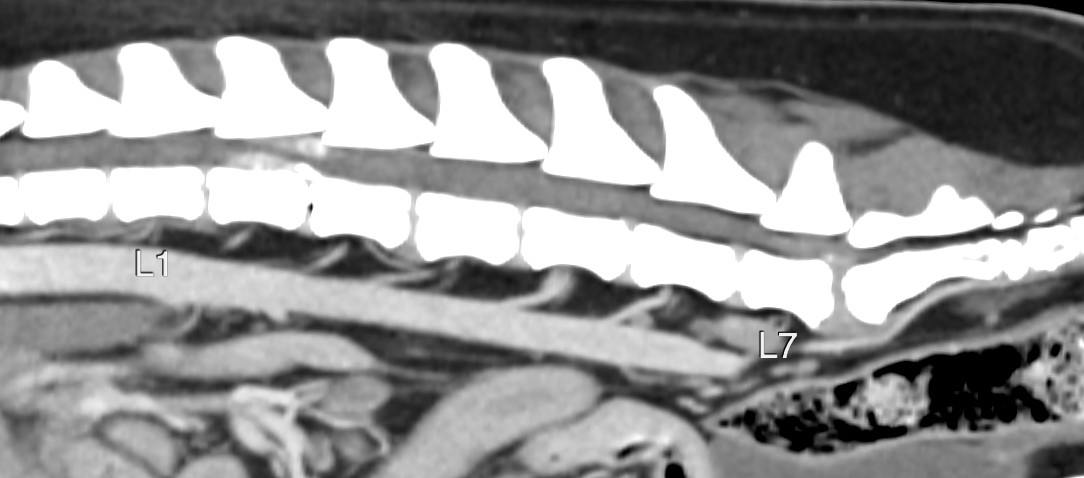 Formation SCANB : Module Scanner: Niveau 2: Vasculaire thoracique et abdominal, tube digestif, surrénales, affections naso-sinusales, cérebrales...