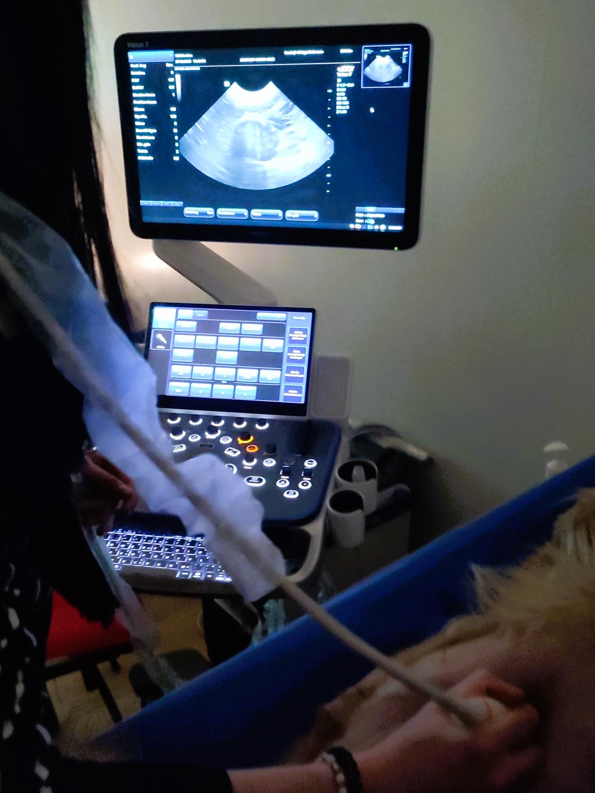 Formation EAN2 : Echographie abdominale normale : Partie 2 - surrénales, noeuds lymphatiques, tube digestif, pancréas, vascularisation.