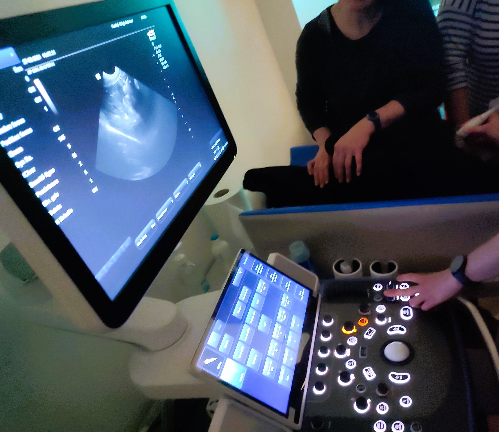 Formation EAN1 : Echographie abdominale normale : Partie 1 - foie, rate, reins, vessie, appareil génital.